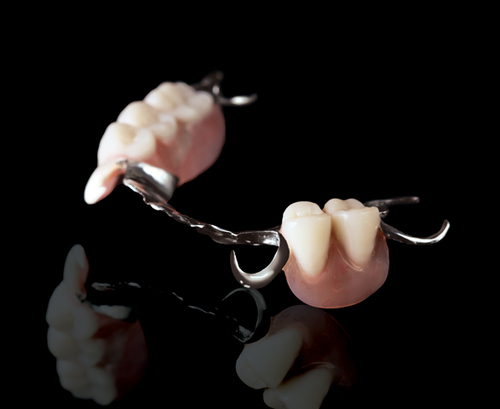 Cast Partial Dentures