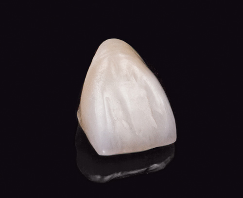 Translucent Zirconia